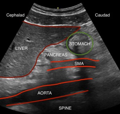 Sonography Image